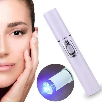 1pc Medical Blue Light Therapy Laser Pen Add 1Pc Varicose