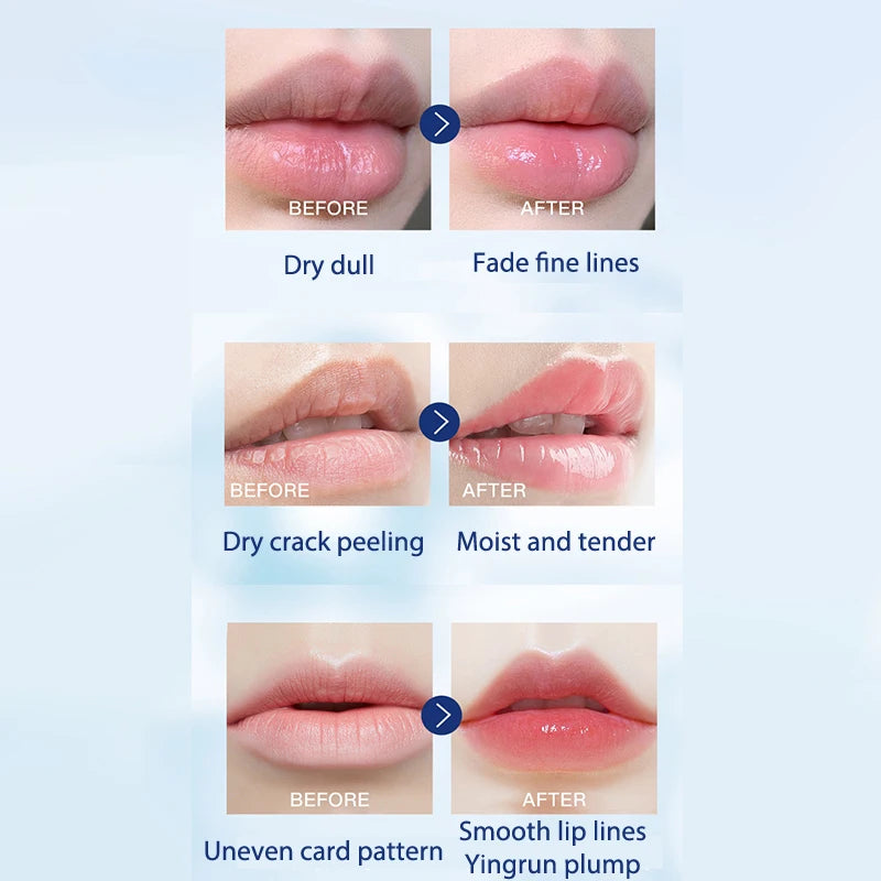 Vaseline Lip Balm Moisturize Prevent Cracking Repair Lines Long-lasting Moisture